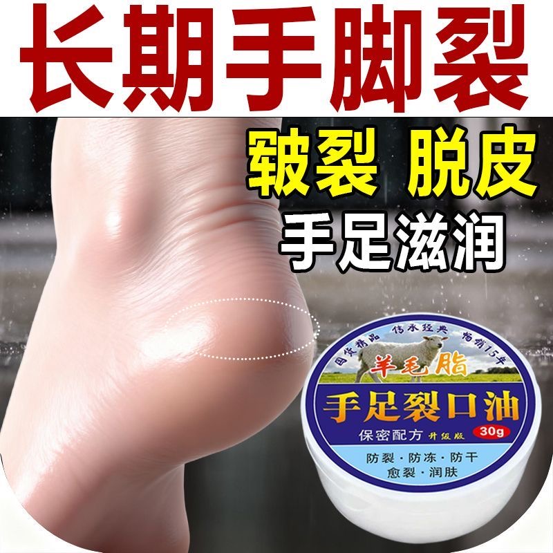 脚后跟开裂足裂手脚干裂防脚跟干燥龟裂保湿滋润护足保湿防裂正品