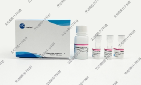 SABC kit(rabbit/mouse)用于IHC/ICC/WB/NB/SB/EMSA检测及ELISA等