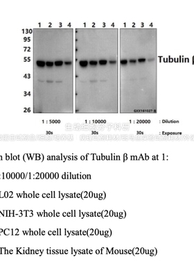 Bioworld β-肌动蛋白多克隆抗体Tubulin β monoclonal antibody