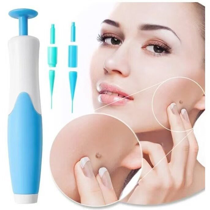 祛皮赘笔祛肉痣祛鸡眼祛疣器工具 蓝色盒装 Skin Tag Removal Too