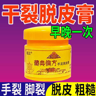 蜕皮专用膏手指鹅掌风干燥粗糙起皮手藓膏脱皮干裂真菌感染严重