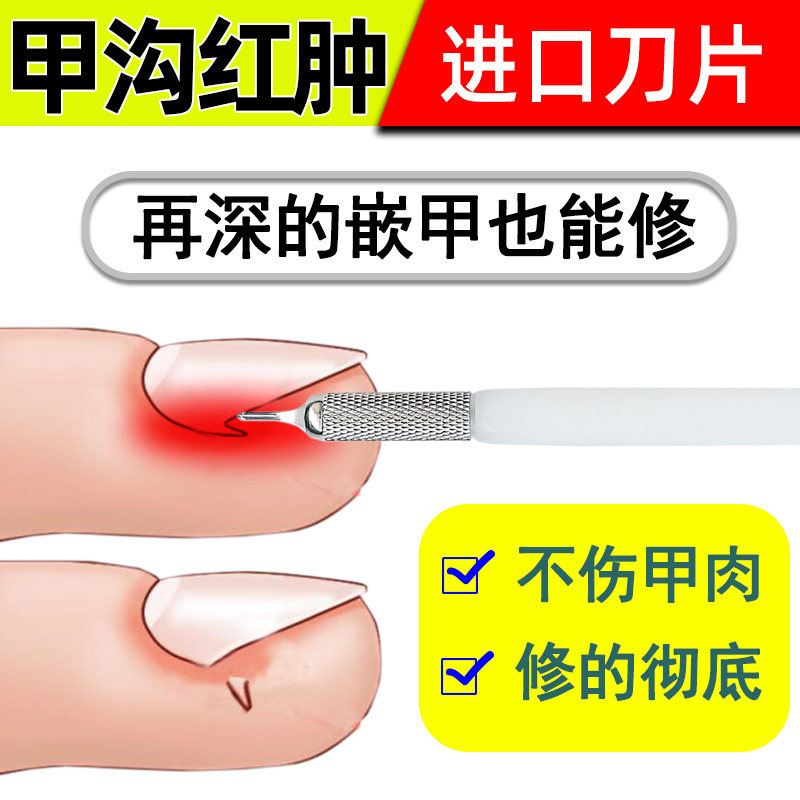 德国甲沟炎专用修甲刀指甲扎肉疼