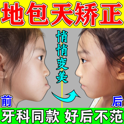 地包天矫正器儿童成人嘴凸下巴颚后缩牙齿纠正棒反颌头套牵引神器