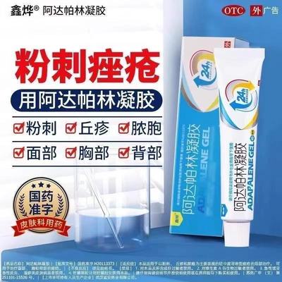 鑫烨 阿达帕林凝胶 0.1%*10g*1支/盒 粉刺丘疹和脓疱及面部的痤疮