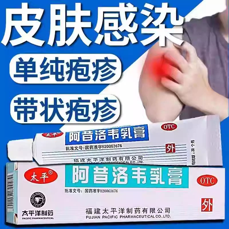 用于带状疱疹 太平阿昔洛韦乳膏3%*10g抑制病毒复制 缓解疼痛