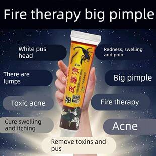 苗疆火疖子拔脓拔毒膏 屁股长痤疮硬块坐板疮红肿大脓包脸部痘痘