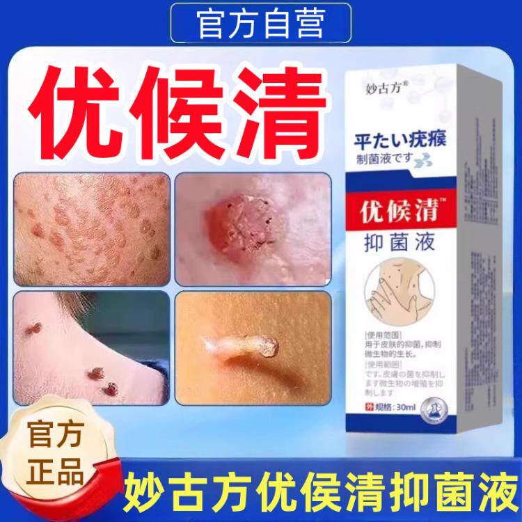 妙古方疣瘊清优侯清抑菌液膏克专用去官方正品旗舰店扁平疣小肉粒