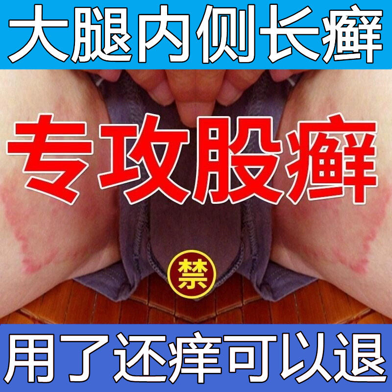 股癣膏药体大腿内侧私处湿疹牛皮藓炎银屑专用根部廯屁股止痒瘙去
