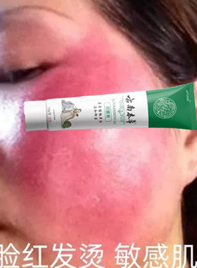 红脸蛋褪红脸过敏脸大红脸敏感肌泛红红血丝遇热发红脸红发热发烫