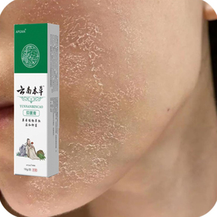 下巴起皮掉皮面部干燥起皮痒脸上过敏皮肤干燥脱皮发红发痒保湿膏
