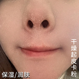 脸上干燥起皮脸干燥干皮脱皮干痒秋冬脸部掉皮发痒皮肤粗糙起干皮