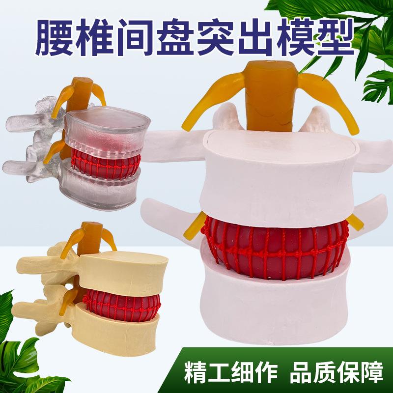 腰椎模型 教学医学人体腰椎间盘受压演示 脊柱骨突出病理骨质教具