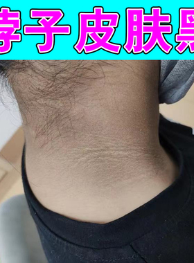 脖子黑黑的修复膏去脖子黑皮肤膏黑色素去颈部黑色素