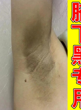 去胳肢窝沉淀暗沉黑色素膏洗不干净黑颜色皮肤