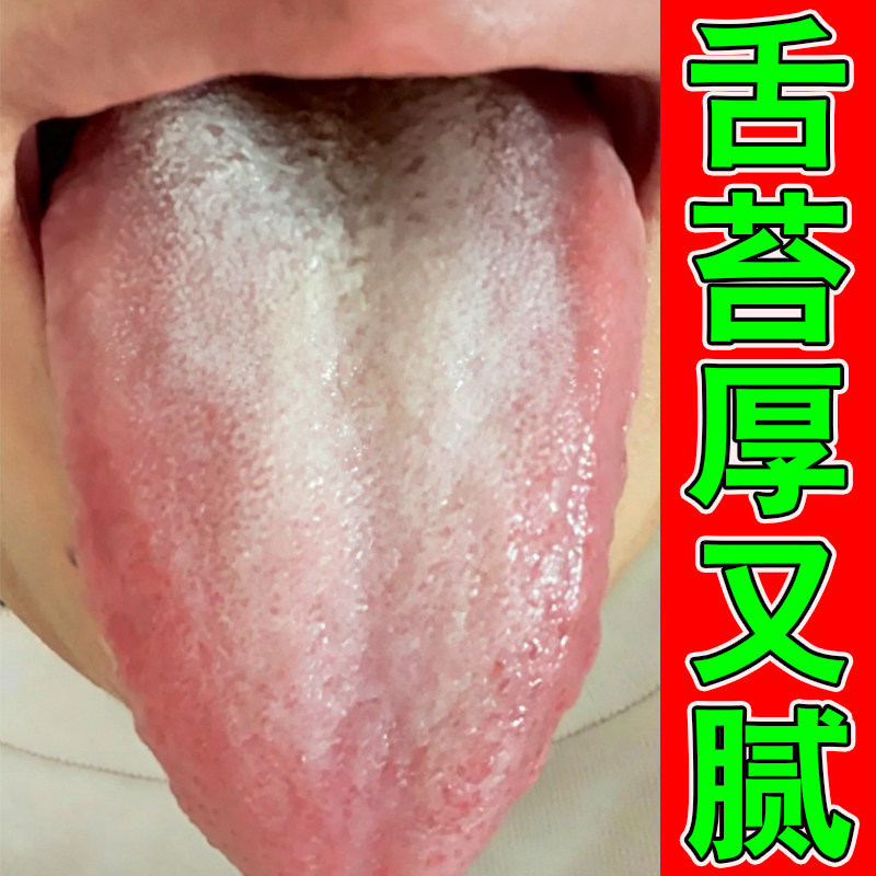 舌苔白厚舌头有裂纹湿气重口干口皮肤消毒护理（消）