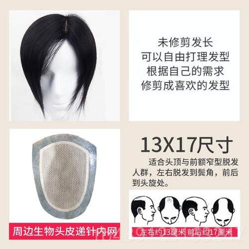 正品男生无痕递发针真发假发片男补发块发男短头顶假发片发士顶假