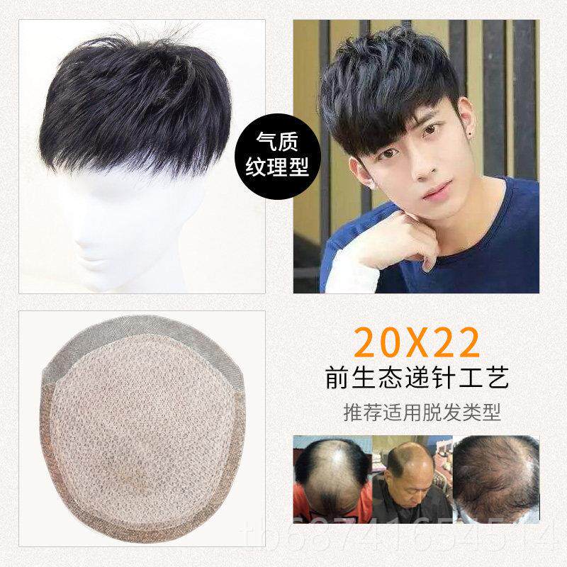 正品士男假男发头顶补发短递针真发补发块线前额发际 线隐形无痕