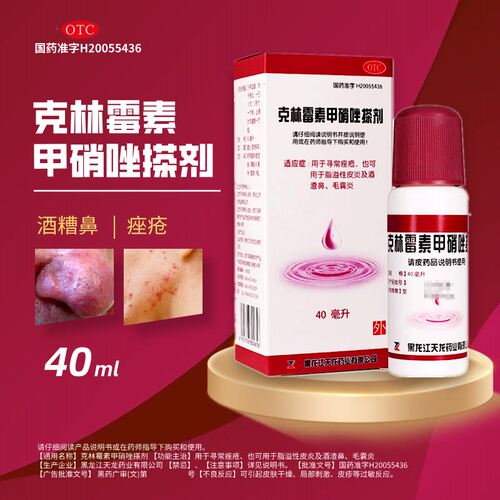 天龙 克林霉素甲硝唑搽剂40ml毛囊炎酒渣鼻寻常痤疮脂溢性皮炎