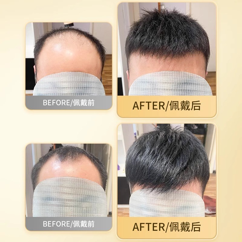 假发男短发寸头帅气真发韩版男士假发隐形男假T发补头顶补发片