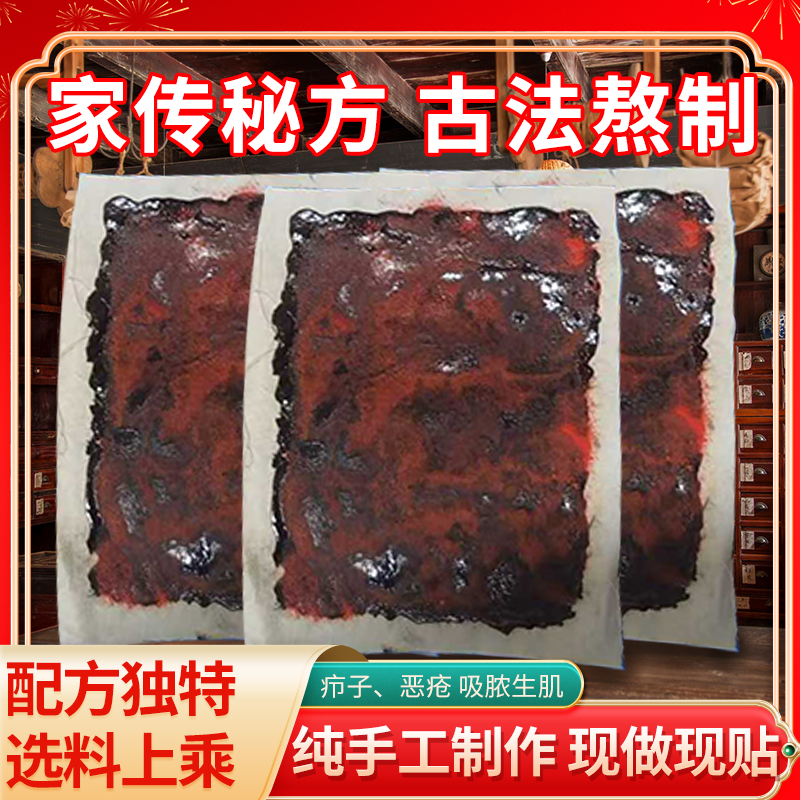 手工膏药祛除火疖子恶疮洗浓生肌