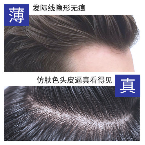 木极客补发假发片男前额头u发际线假发贴前额男生隐形短发韩版帅