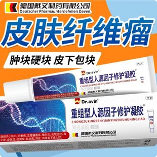 皮肤皮下硬疙瘩皮下硬结硬块结节贴纤维瘤