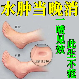 脚肿消肿的药利尿排水肿神器足部去老人小腿部下肢浮肿特效专用