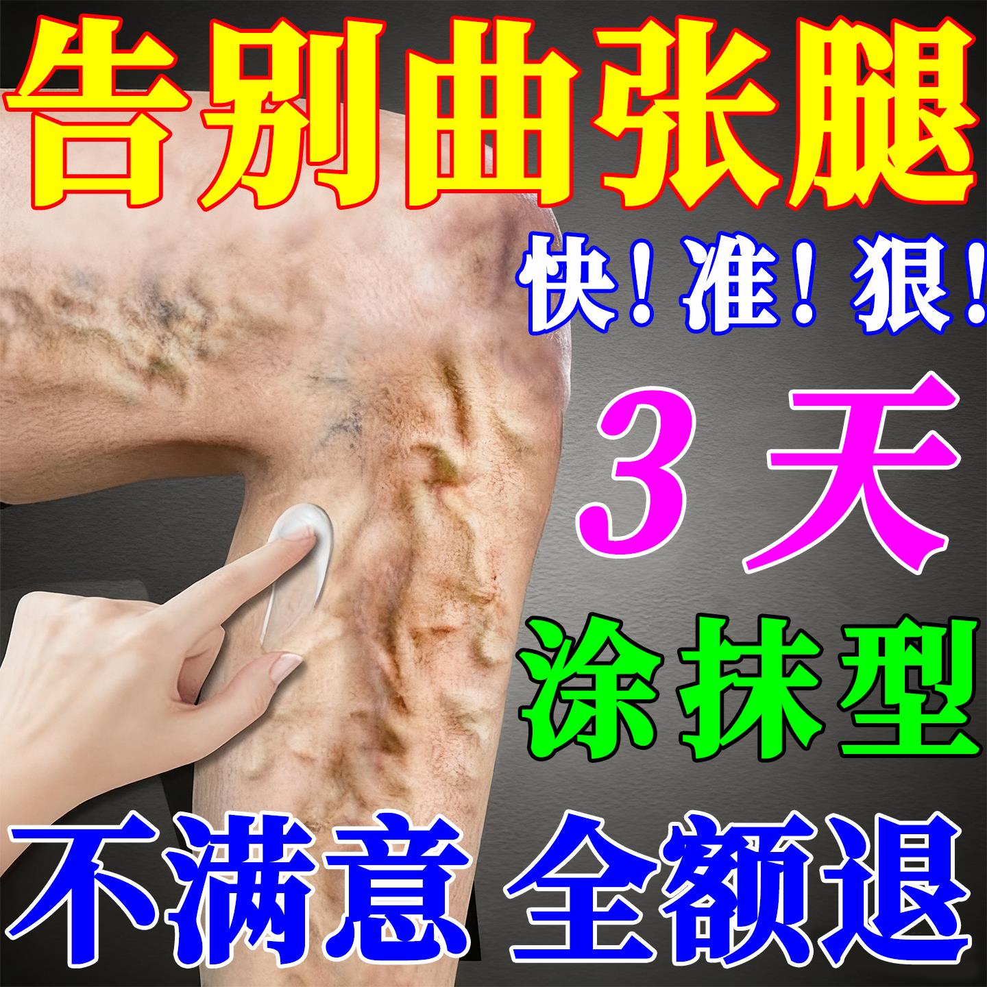 【冶曲张专业技术】静脉