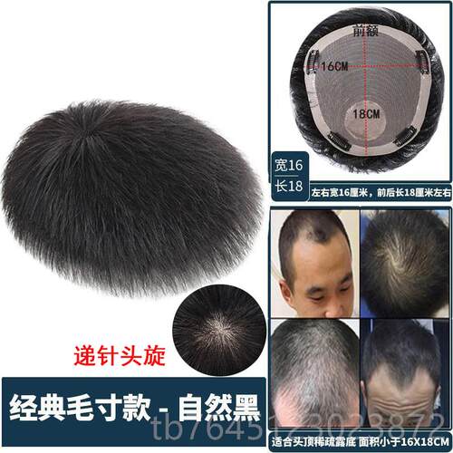 高档假发短发真发帅毛寸补发片男士秃顶头轻顶补发薄自然透气气男