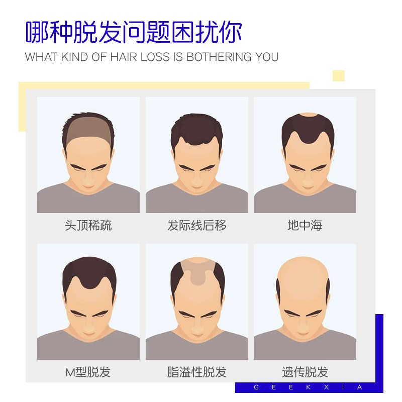 火极客侠假发男士假发定制隐形发际线假发片秃顶无痕补发超薄假发