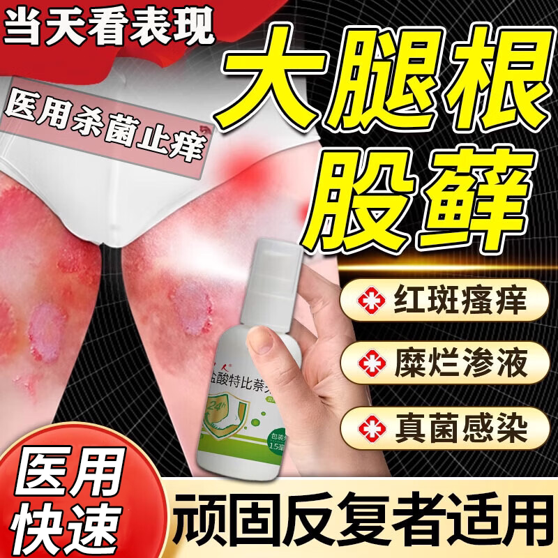 股藓专用药大腿内侧皮肤瘙痒股藓止痒去药根真菌感染喷雾杀菌止痒
