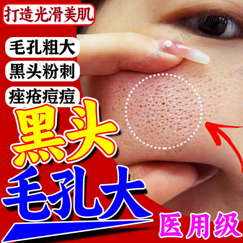 【明康欣】阿达帕林凝胶0.1%*10g*1支/盒