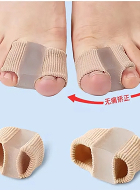 家用分趾器缓解脚趾挤压超舒服