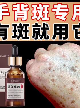烟酰胺美白祛斑精华液手上老年斑强力去除手部脸部官方旗舰店正品