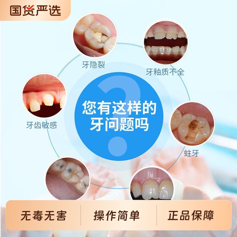 补牙材料树脂牙齿自己在家牙缝洞神器填充膏假牙牙套自补修补临时