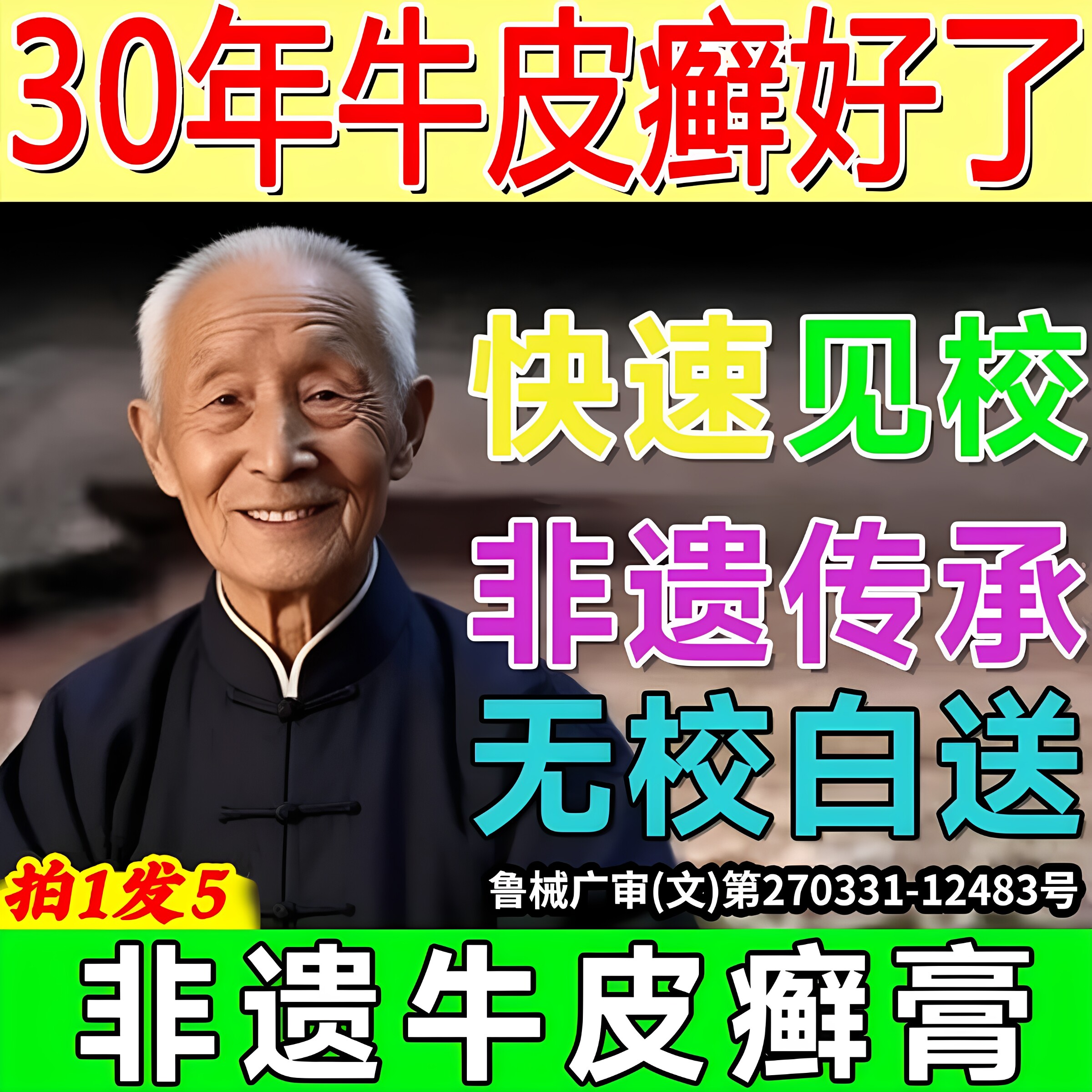 牛皮藓癣鲜银屑病手足体股头皮肤保健理疗