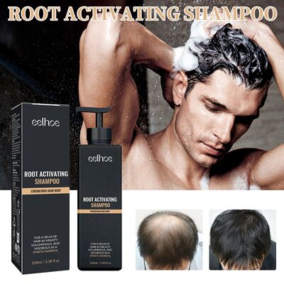 Shampoo Gently Clean Hair Remove Dandruff Control Oil Reduce