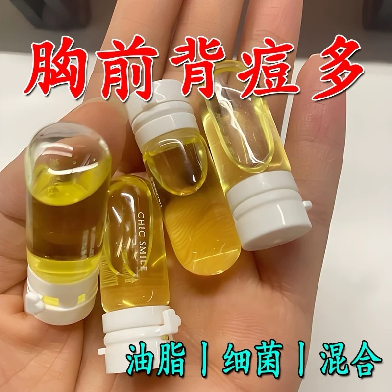 【背痘不见了】祛痘去背上痘痘前胸背后长痘身体除螨去痘印背粒消