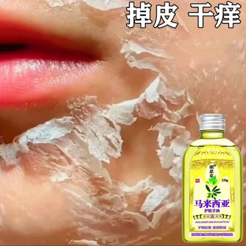 脸上起皮掉皮干皮脸起皮发痒嘴边干燥起皮干皮脸上脸干痒涂抹膏