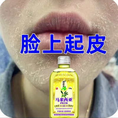 脸上起皮掉皮干皮脸起皮发痒嘴边干燥起皮干皮脸上脸干裂痒乳膏