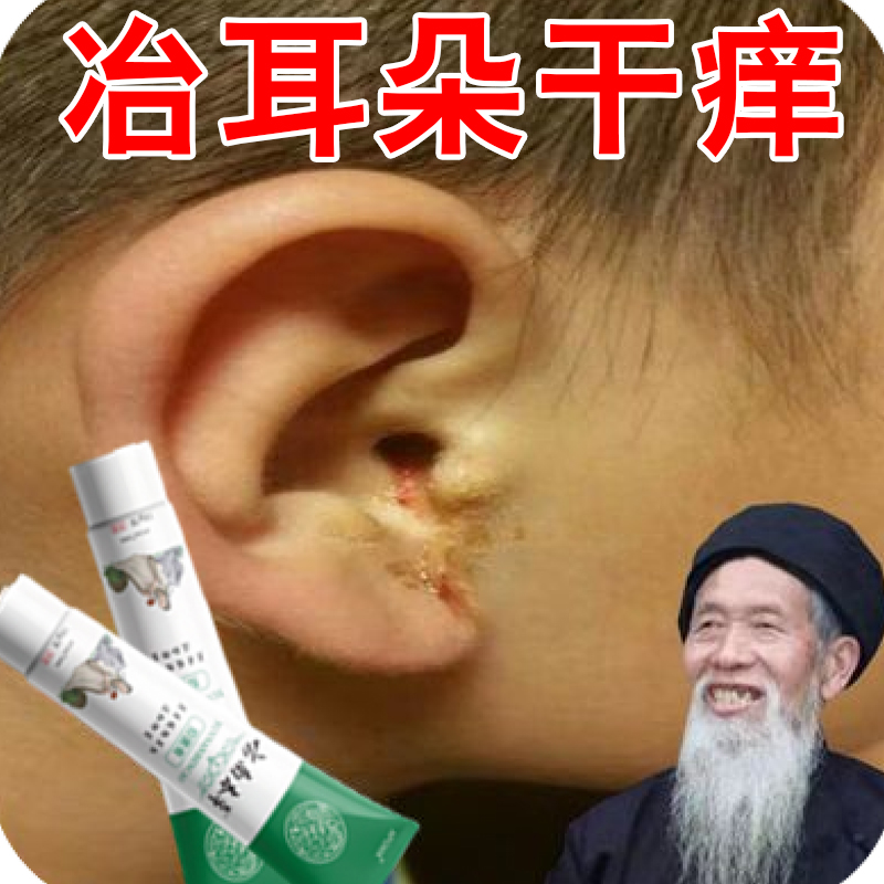 耳朵起皮屑干皮耳朵根裂结痂耳痒起皮干燥耳周起皮红痒红肿耳痒痒