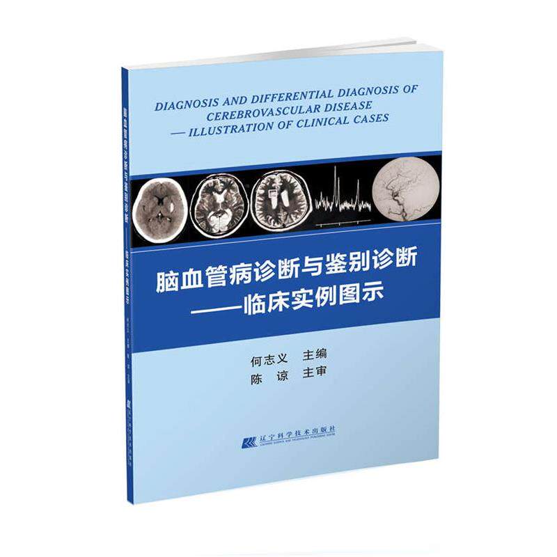 【正版书】 脑血管病诊断与鉴别诊断--临床实例图示 何志义 辽宁科学技术出版社