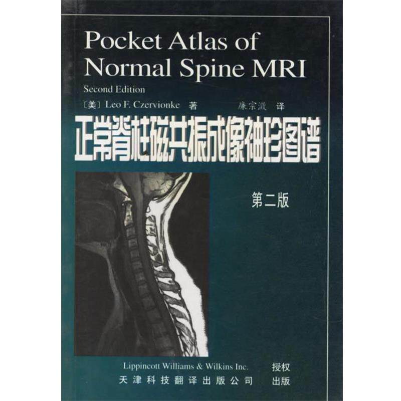 【正版书】 正常脊柱磁共振成像袖珍图谱 (美)兹尔威克 著,廉宗澂 译 天津科技翻译出版公司