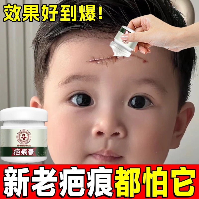 香港大药房祛疤痕膏痘印凹凸老手术除疤痕烫伤摔伤增生消疤修复膏