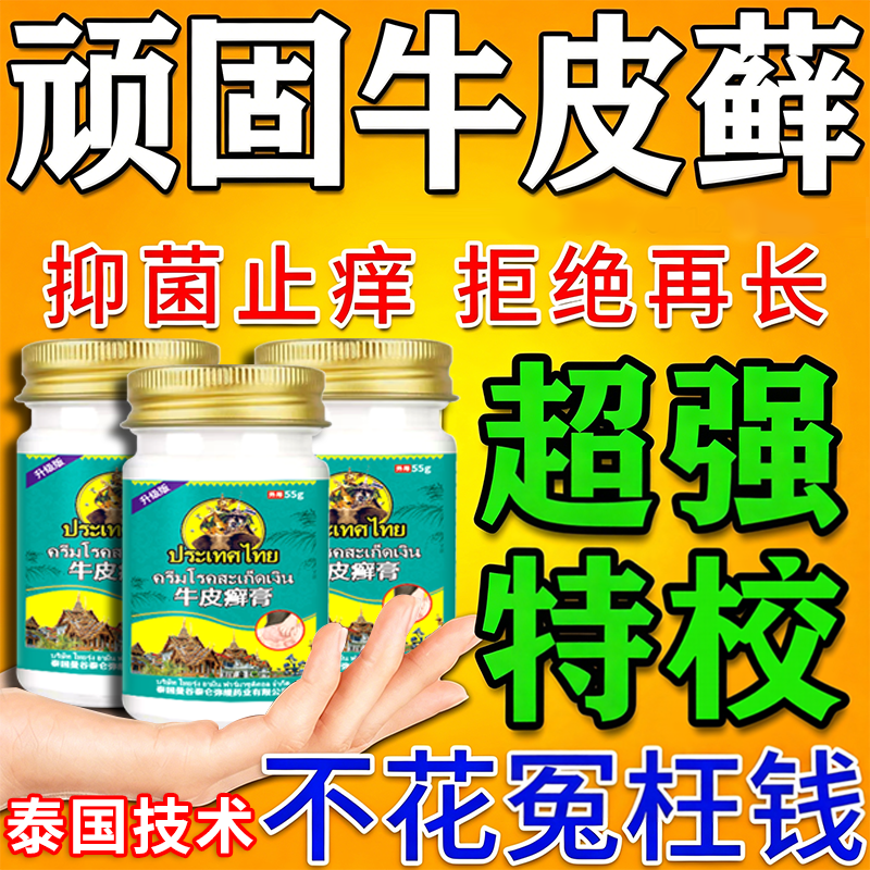 泰国治疗顽固性牛皮藓银屑病效特专外用膏药皮肤真菌感染杀菌膏药