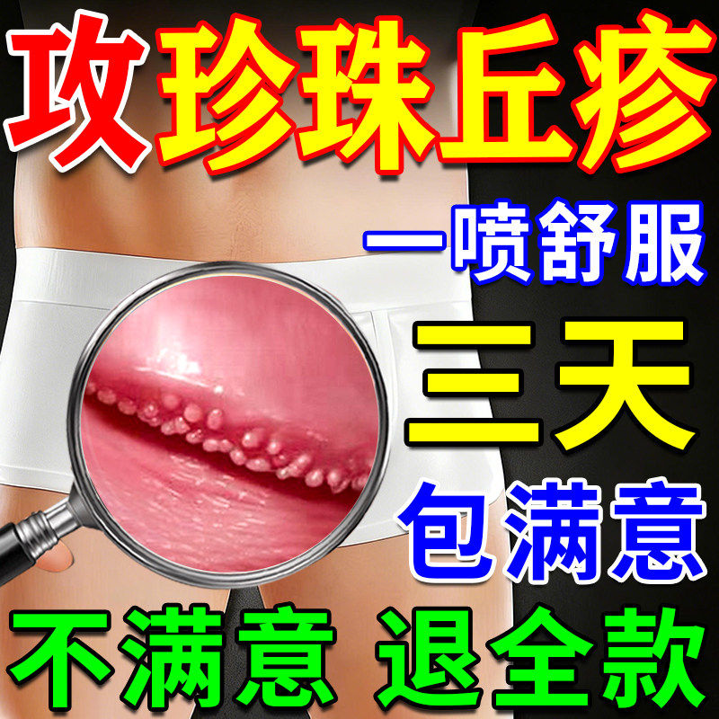 包皮龟头炎珍珠丘疹专用膏药男性冠状沟粒疹阴茎小疙瘩保健药软膏