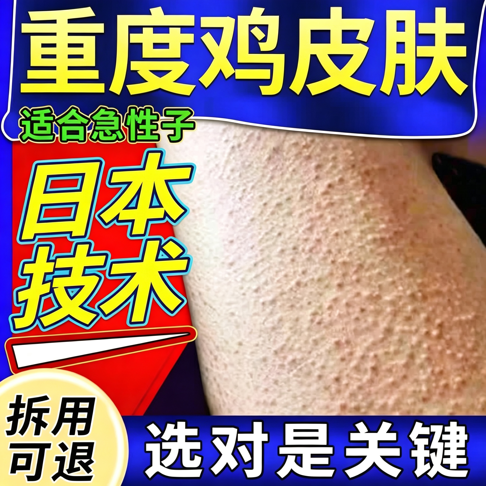 日本鸡皮肤疙瘩毛囊角化症专用膏保湿滋润女皮肤干燥腿部鱼鳞去除