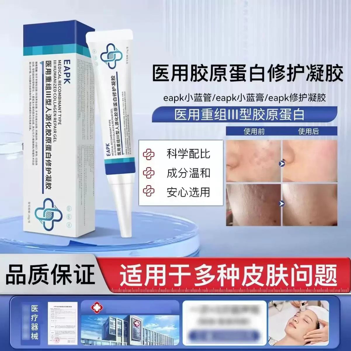 eapk小蓝管祛痘印凝胶医用修复淡化红黑痘坑青春痘去痘膏闭口粉刺