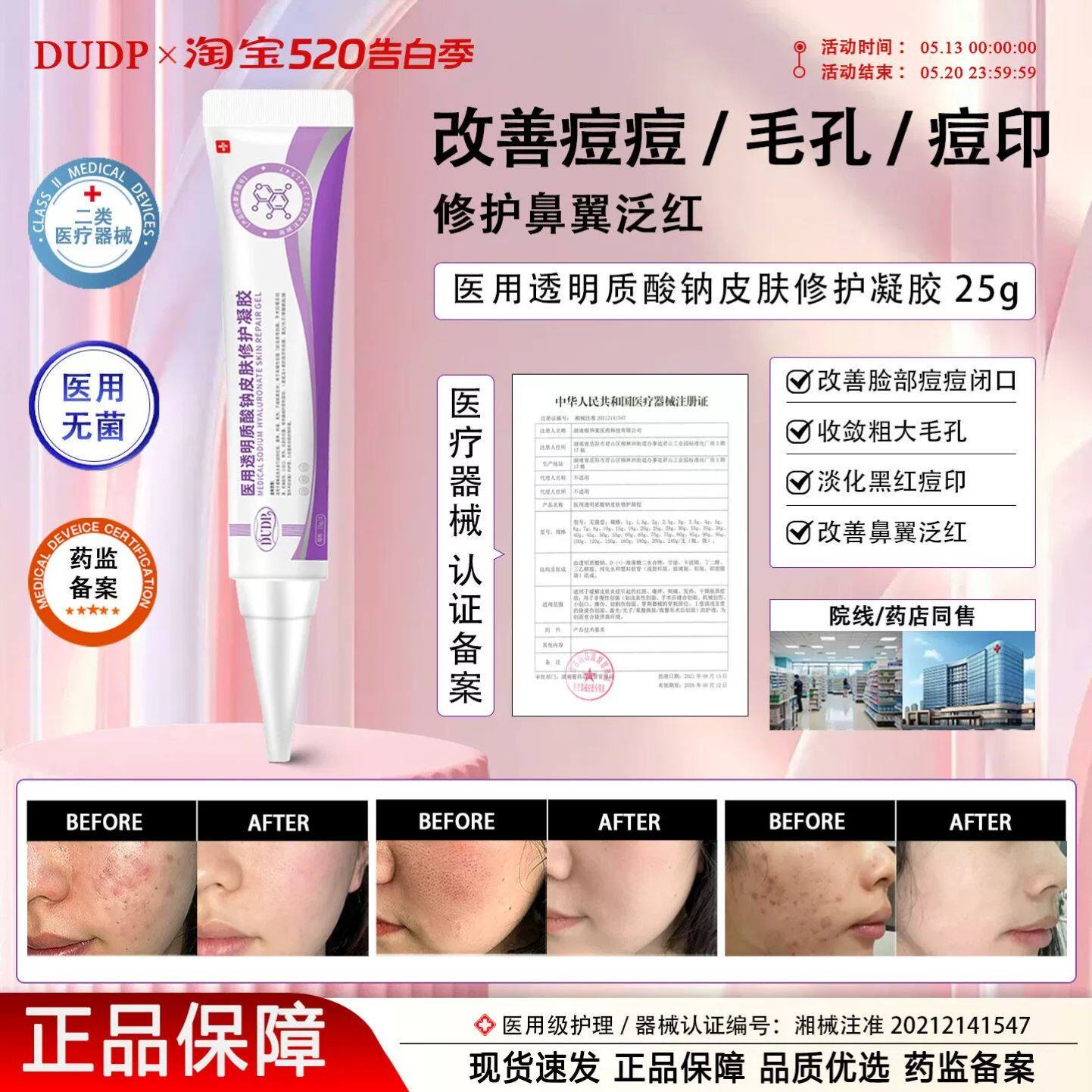 Dudp医用透明质酸钠Dudp小紫管dp凝胶细致毛孔淡化痘印祛痘痘痤疮 - 实物图
