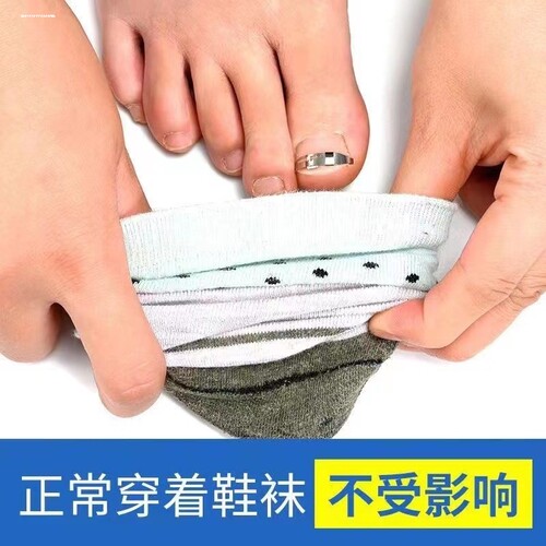 嵌甲矫正器沟矫正器脚趾甲沟脚指甲纠正神器正甲扣专用炎正甲贴